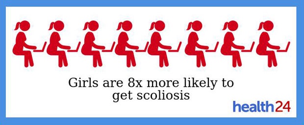 girls,scoliosis,spines