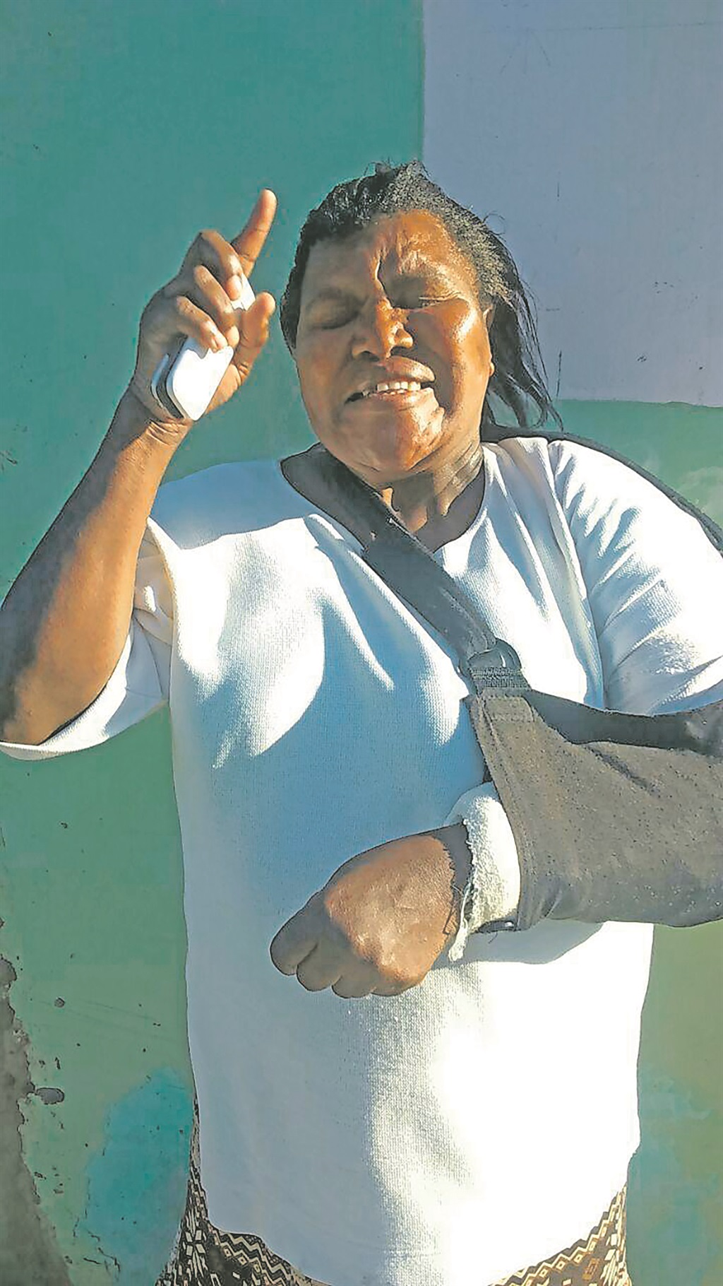 Kholeka Ngxulu is nursing injuries and a broken arm.               Photo by Sivuyile Ndawuni