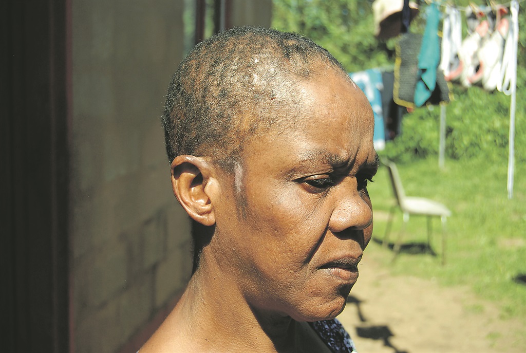 The woman said she has been having sleepless nights since she was allegedly attacked.     Photo by Phumlani Thabethe