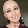 Fitness blogger who lost all her hair as a teen now proudly posts inspiring selfies of her bald head