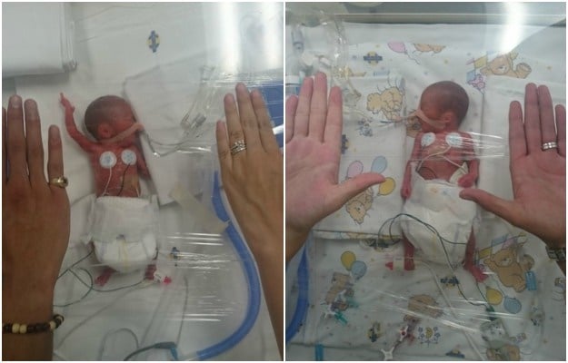 Miracle 'micro-prem' twins were born at 24 weeks - but ...