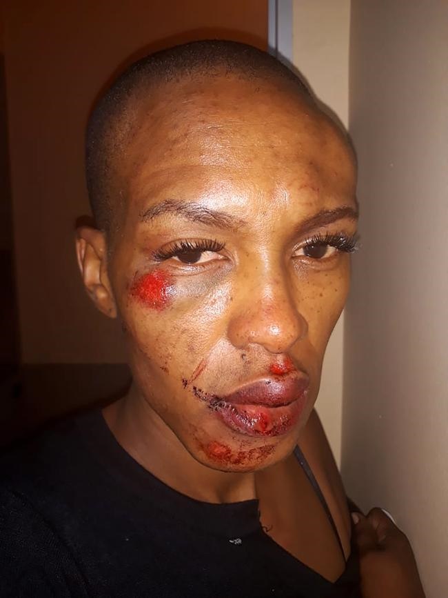 Khuselwa Mkhwanazi says she was beaten up by her boyfriend. 