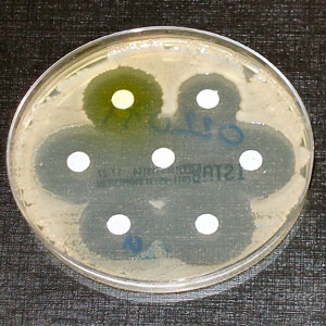 Antibiotic resistance tests: Bacteria are streaked on the dish on which antibiotic impregnated white disks are placed.Source: Wikimedia Commons