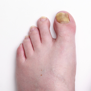 Have you got nasty feet? Here's what you can do about it. 
