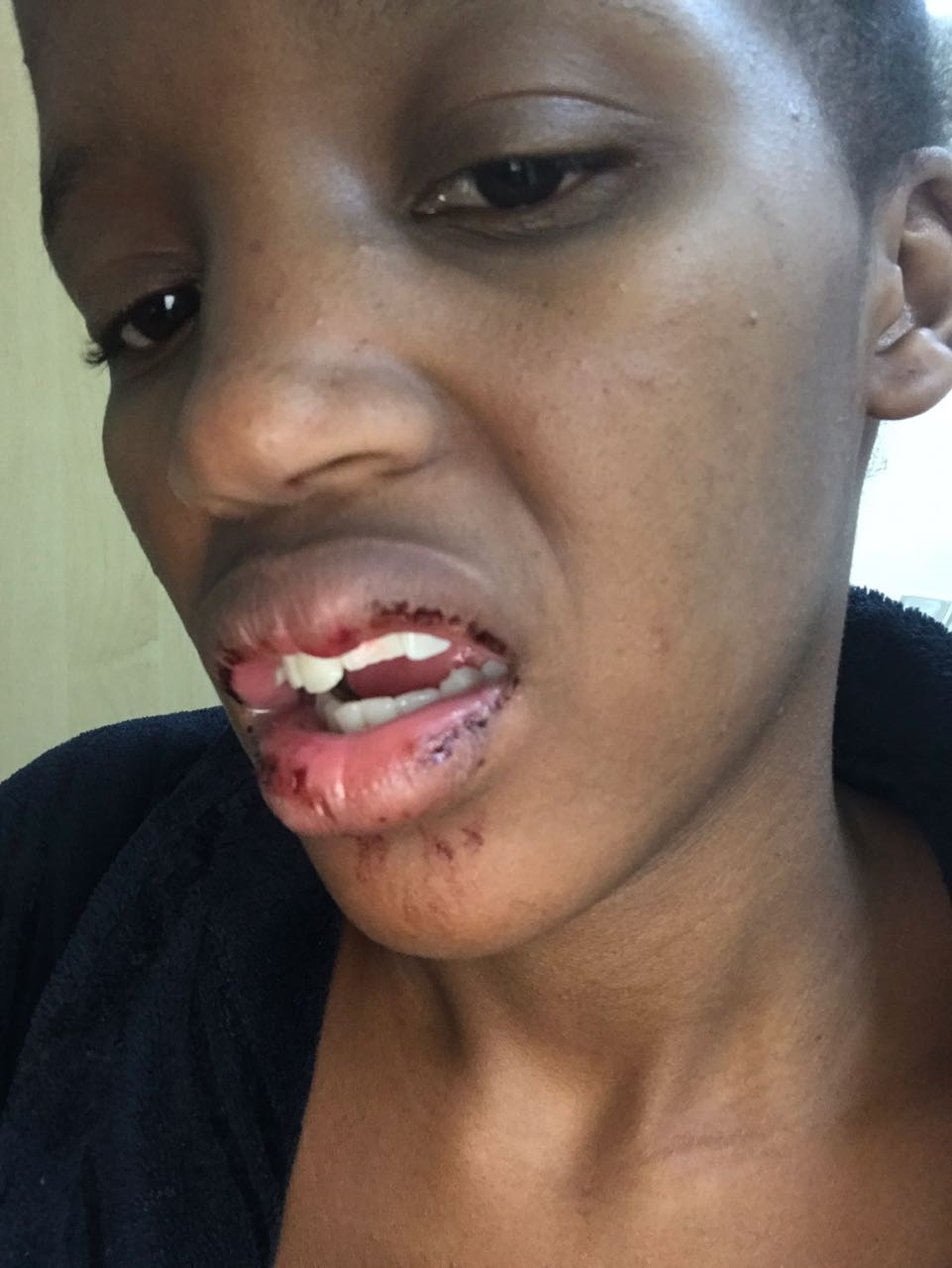 Neo Tsele claims she has been assaulted by Mthokozisi Ndaba. Picture: Supplied 