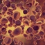 Killer T-cell therapy shows promise against leukaemia