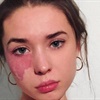 ‘The best thing is when people tell me that I've inspired them’ Woman with large facial birthmark goes viral for her inspirational body-positivity message