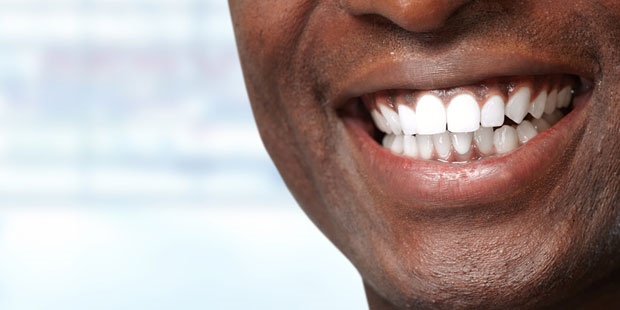 man,teeth