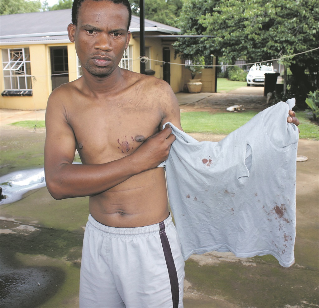 Phumlani Shazi says four dogs in Randfontein nearly killed him.  Photos by     Stephens Molobi