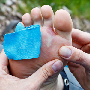 Runners, don't be embarrassed by your feet. 