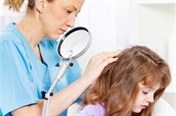 Diagnosing head lice
