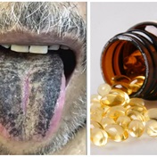 From a man with a black, hairy tongue to a vitamin D overdose, here are 3 fascinating medical cases from 2022