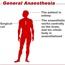 General anaesthesia: how it works