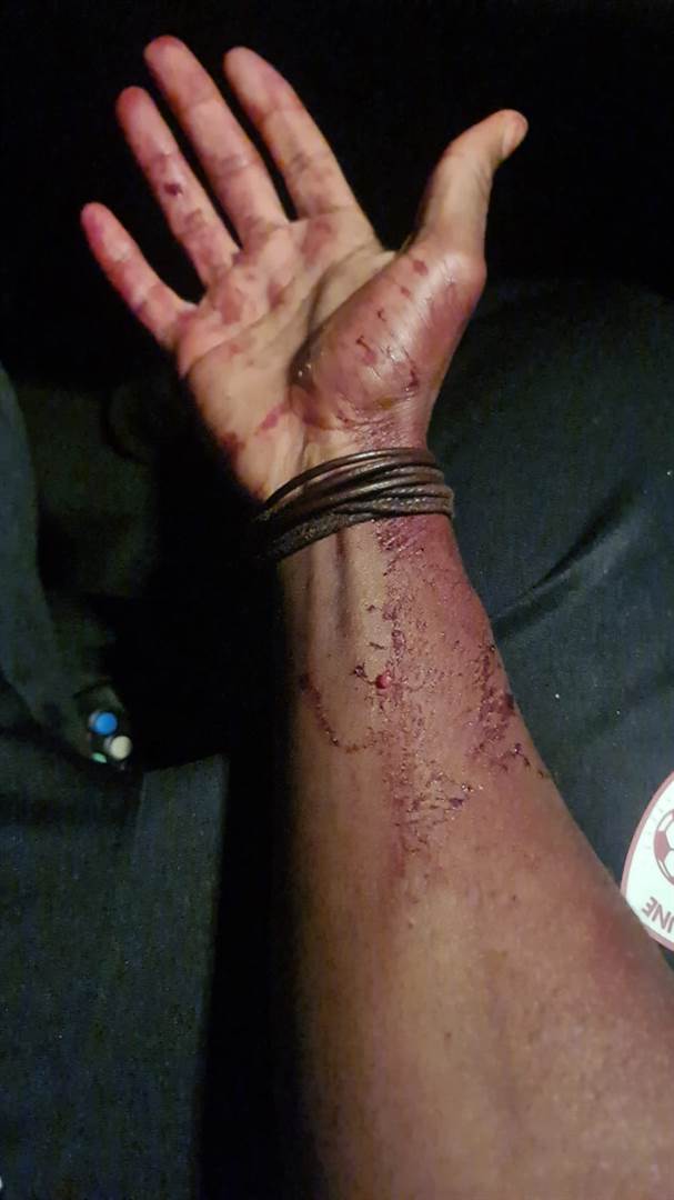 Images of blood on Katsande's hand following the a
