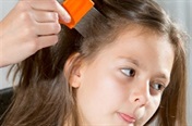 Treating head lice