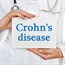 Risk factors for Crohn's disease