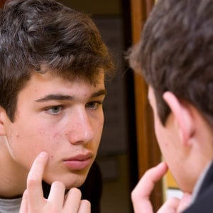 Acne is a very common skin condition. 