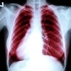 Is COPD irreversible?