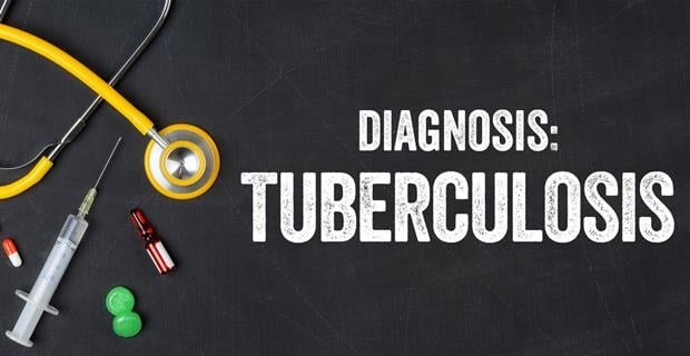 how is tuberculosis TB diagnosed