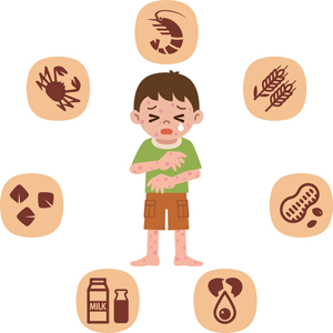 Learn how to recognise the early signs of anaphylaxis.