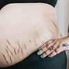 The heartwarming reason this photographer paints scars and stretch marks gold