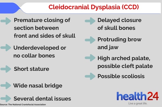 CCD Cleidocranial dysplasia Gaten Matarazzo Strang