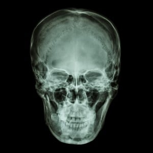 head x ray pictures