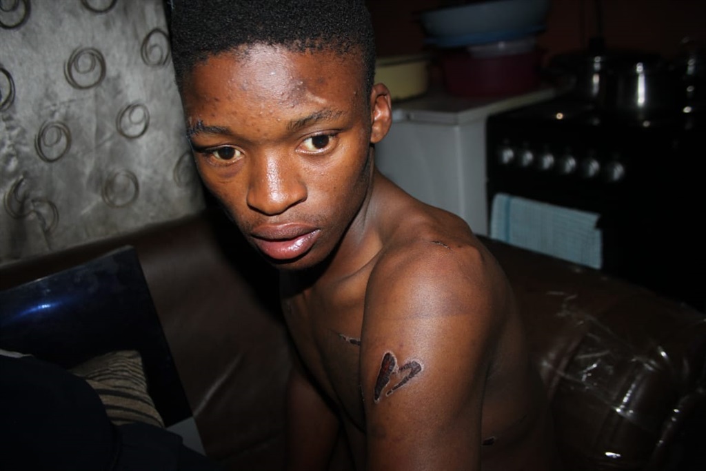 Siyabonga Nkosi, who said he was attacked by residents after fleeing from kidnappers. Photo by Phineas Khoza