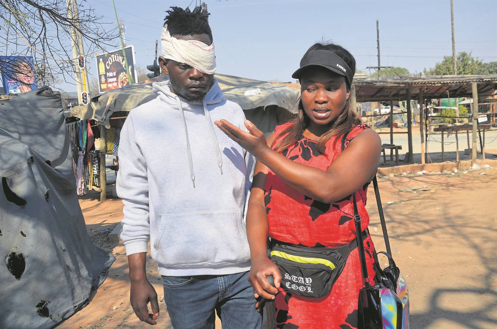 Hlayiseka Mkhabela who was attacked by an armed gang in Gottenburg Village with his sister, Selda Mnisi.    Photo by                                Oris Mnisi