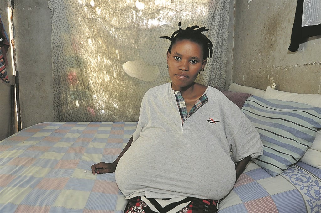 Asanda Ndende has two growths under her armpits.    Photo by     Jabulani      Langa