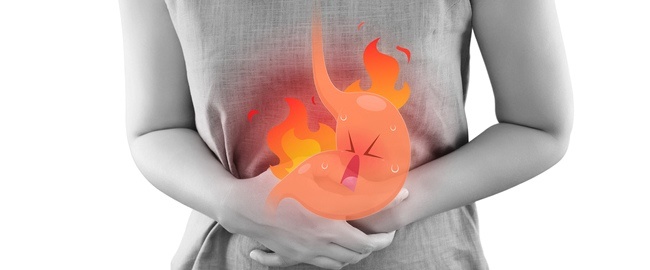 Heartburn | Acid Reflux | Health24