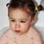 The serious side of chicken pox