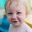 Does chickenpox protect against skin conditions?