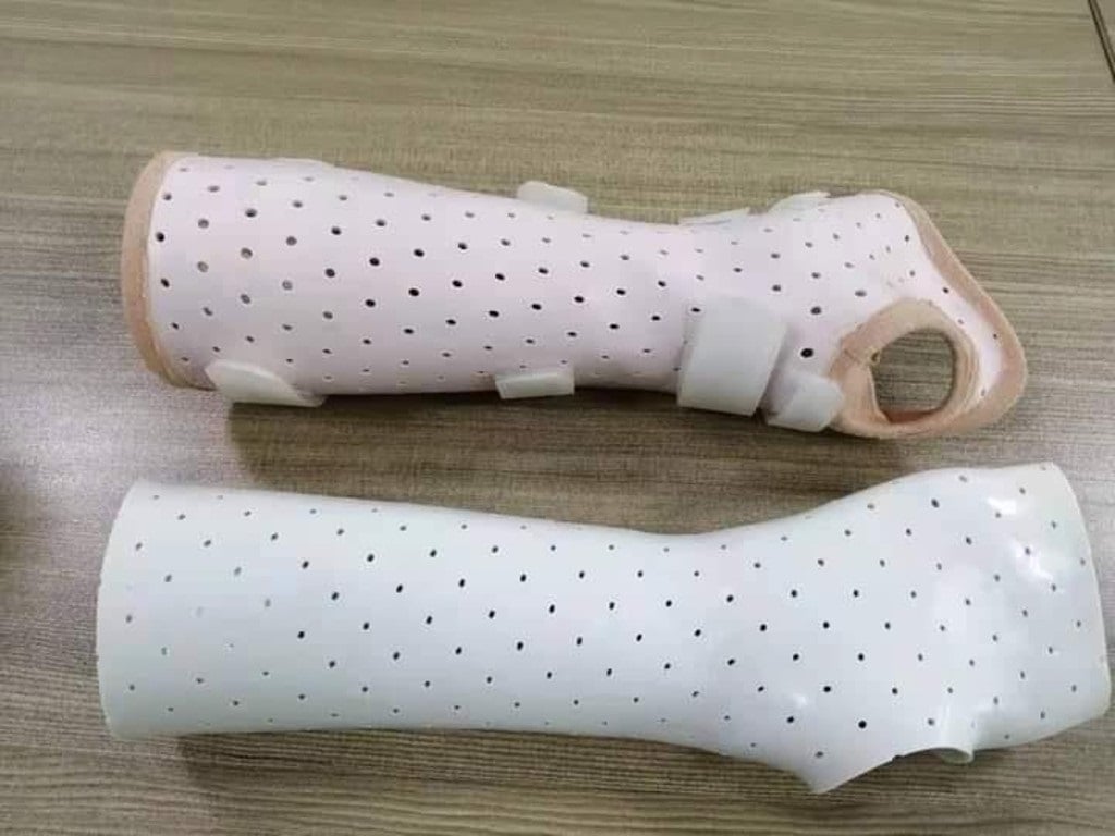 Woman plans to help fellow Rwandan amputees get prosthetics