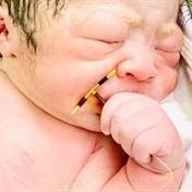 A baby was born holding his mother's IUD