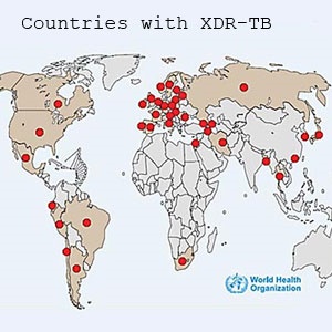 Countries with XDR-TB, from the World Health Organization. 2014.