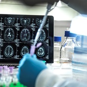 Alzheimer's drug succeeds in slowing cognitive decline, makers Eisai and Biogen say