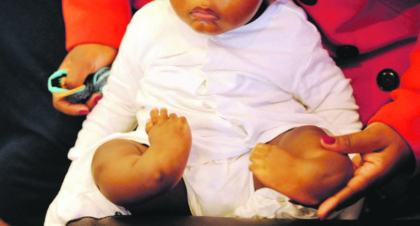 Seven-month-old Mnqobi Nhlanhla was born with both his legs deformed by tibial hemimelia. Picture: Tebogo Letsie