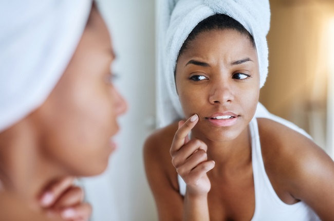 An expert shares the most common mistakes acne sufferers make. 