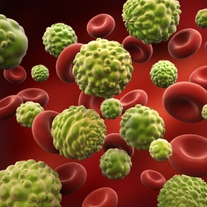 Cancer cells - iStock