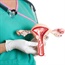 New South African research accelerates cervical cancer treatment