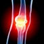What are the alternatives to having surgery for severe knee pain?