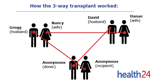 kidney transplant, 3-way kidney transplant