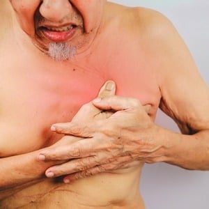 Male breast cancer occurs in one in 1 000 men.