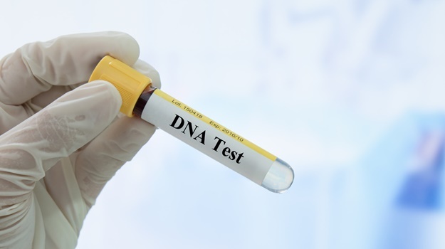 Over R250 million has been allocated to clear a backlog in DNA testing.
