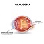 Glaucoma: Background physiology