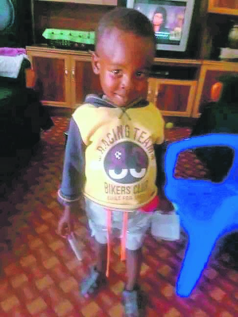 Keketso Saule was playing with other kids when he was attacked by dogs at the weekend.