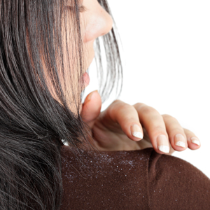 Did you know that dandruff is actually a disease? 
