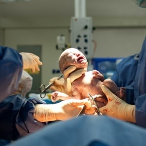 Researchers investigated why doctors opt for C-sections, rather than natural birth.
