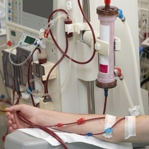 Dialysis is used to purify the blood of people whose kidneys are no longer working properly.